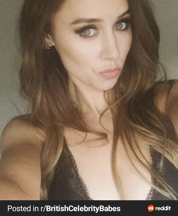 Una Healy. picture 3 of 3